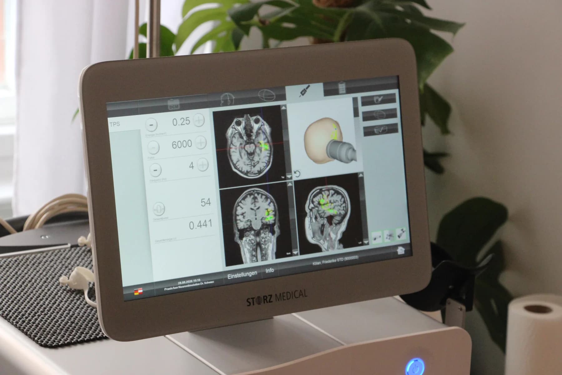 Navigationsbildschirm mit den MRT-Aufnahmen des Patienten